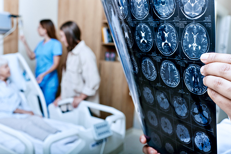 Photo of a stroke care doctor at St. Mary's stroke center looking at a neurological scan.