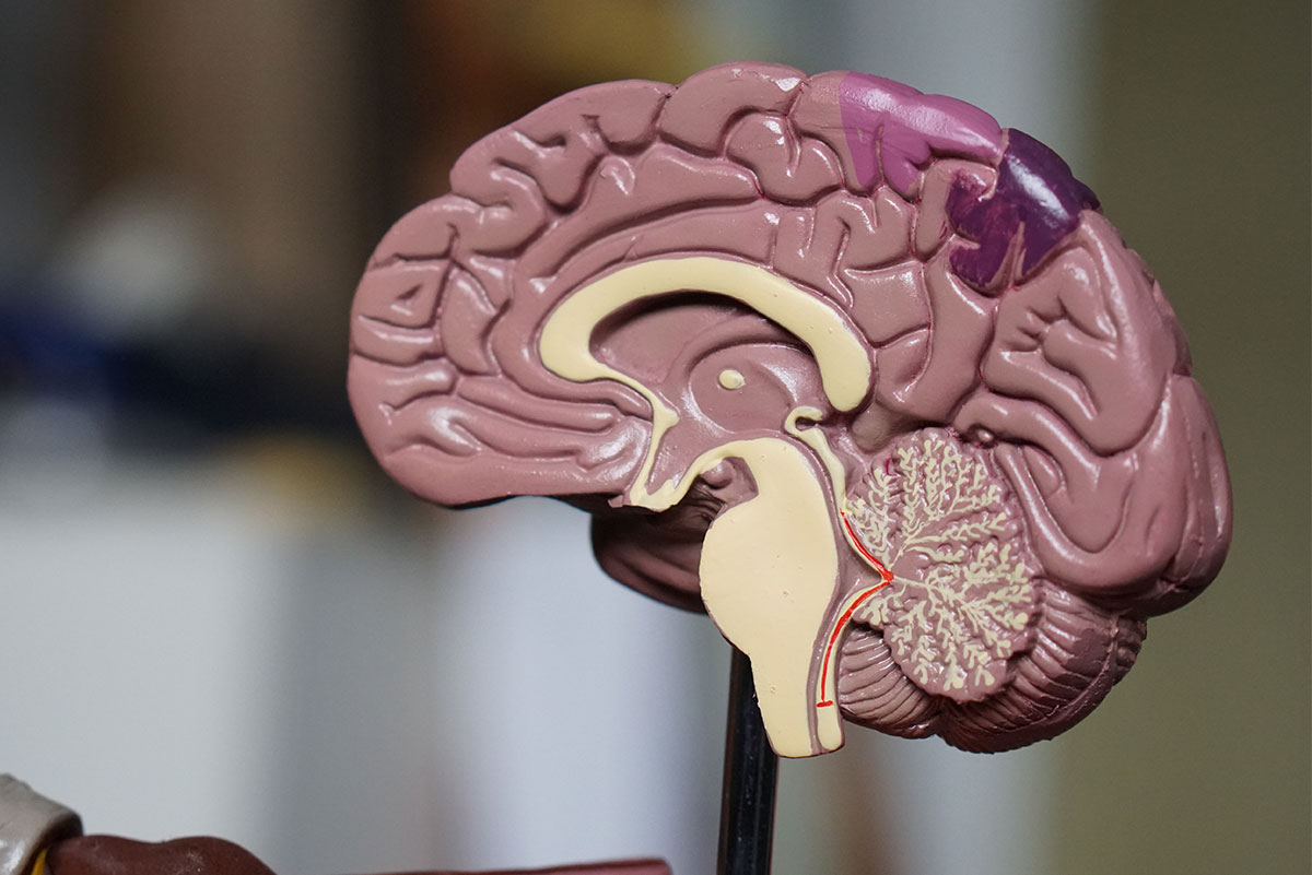 5 Early Signs and Symptoms of Alzheimer's