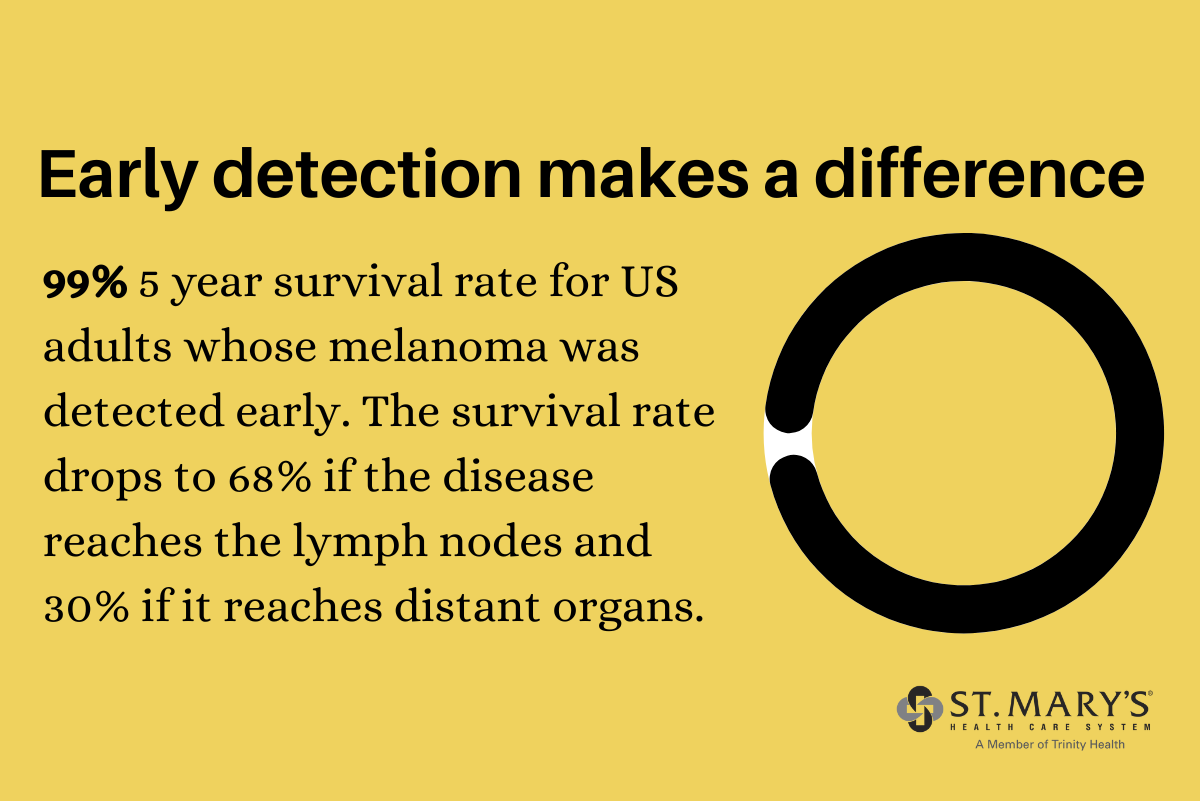 Mole or Skin Cancer? Knowing the ABCDE Rule