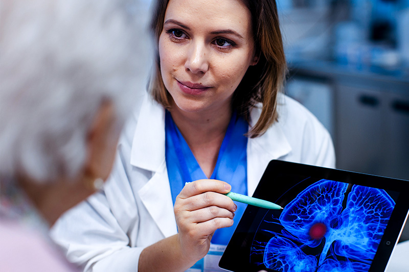 How Stroke Affects the Body